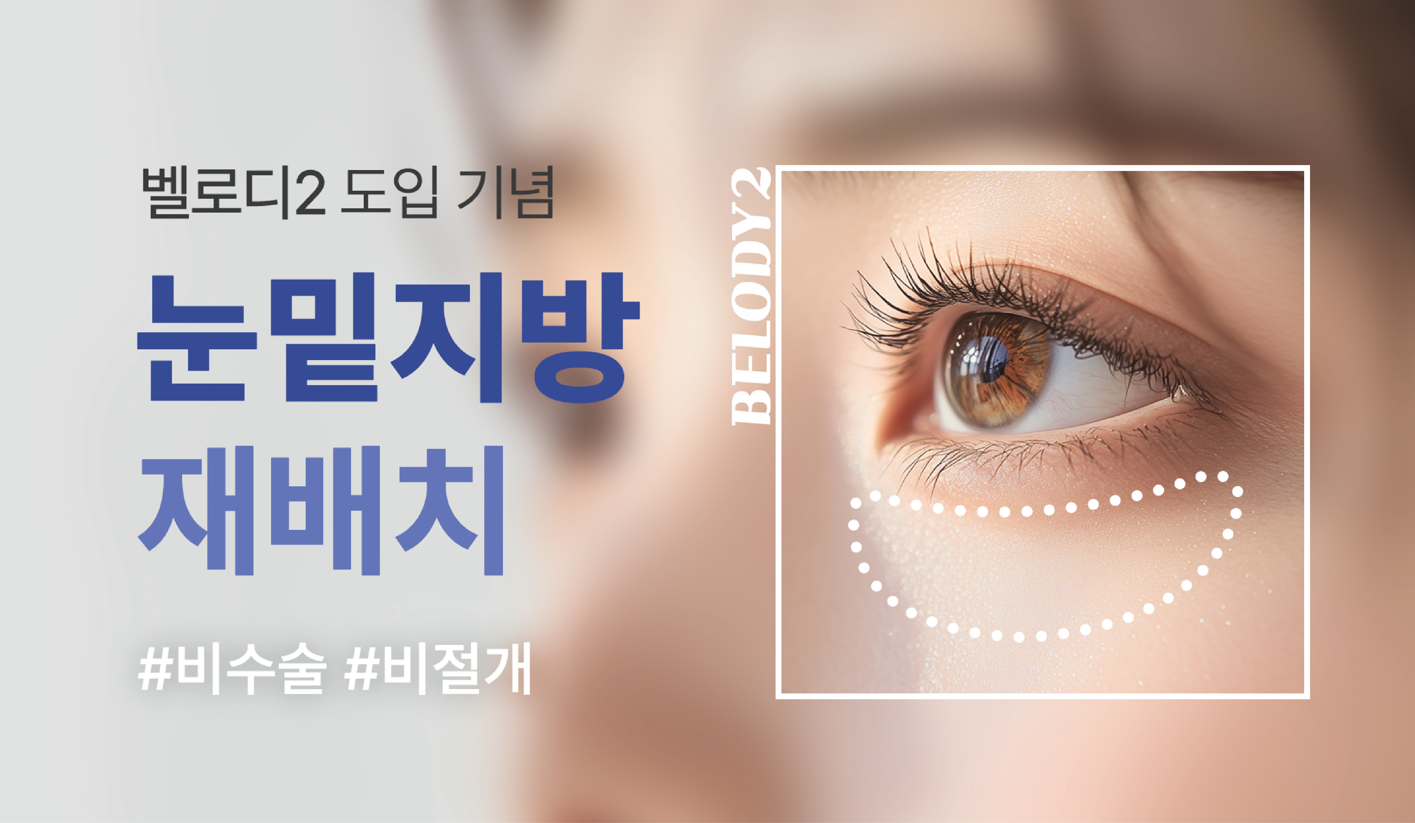 이벤트썸네일