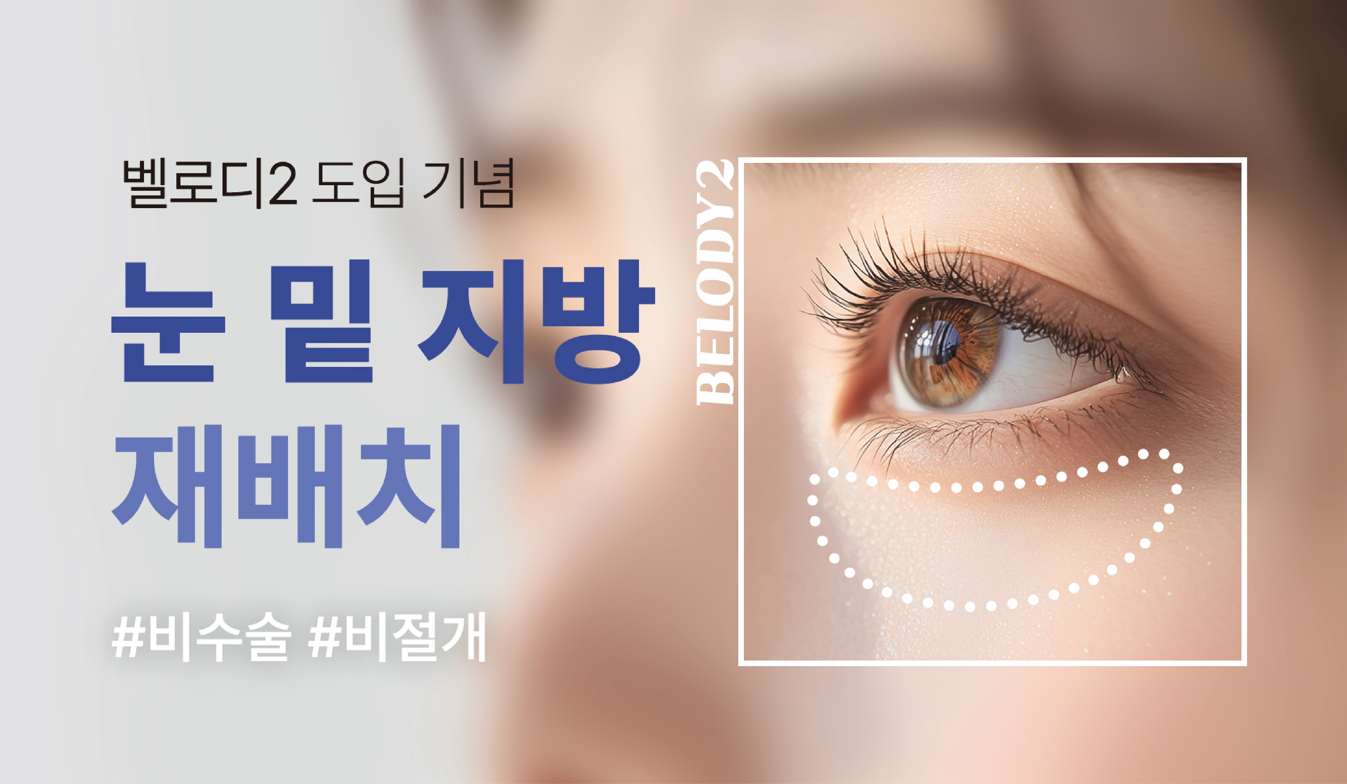이벤트썸네일