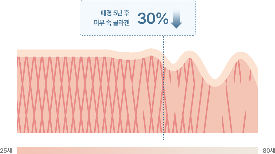 스컬트라이미지